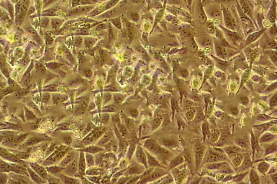 COV434 Cell|人卵巢颗粒肿瘤细胞