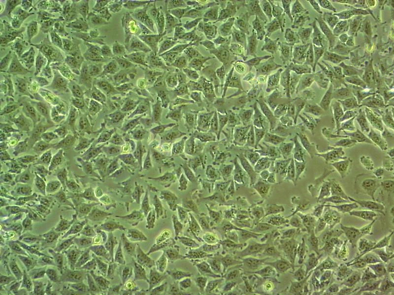 SKM-1 Cell|人骨髓增生异常综合征细胞