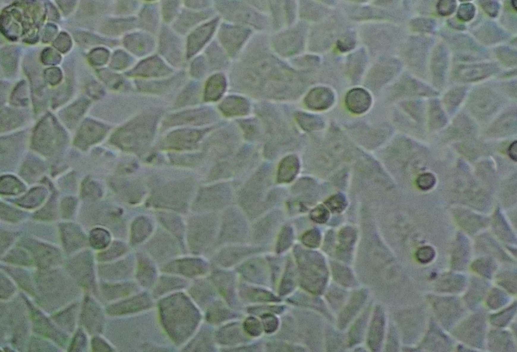 MDA-PCa-2b Cell|人前列腺癌细胞