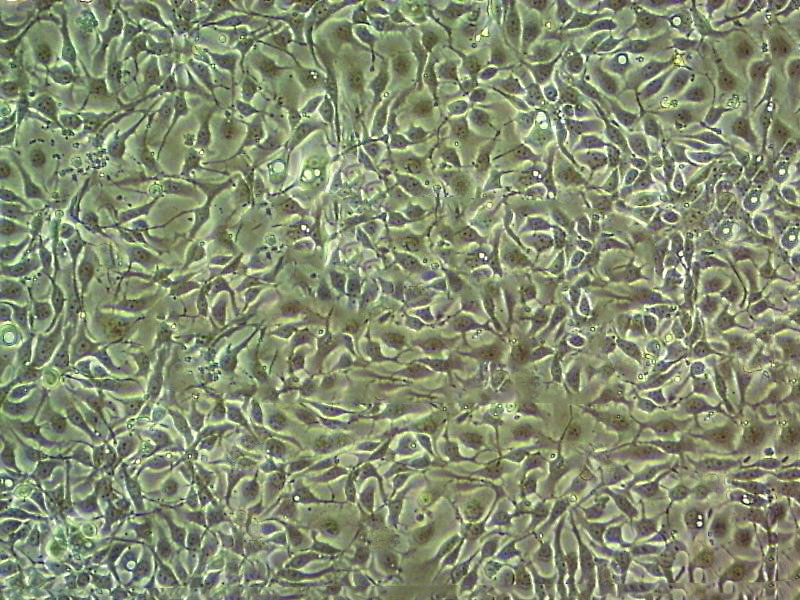 G-361 Cell|人黑色素瘤细胞