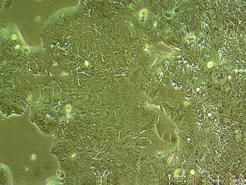 Malme-3M Cell|人恶性黑色素瘤细胞