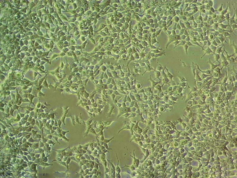 MeWo Cell|人恶性黑色素瘤细胞