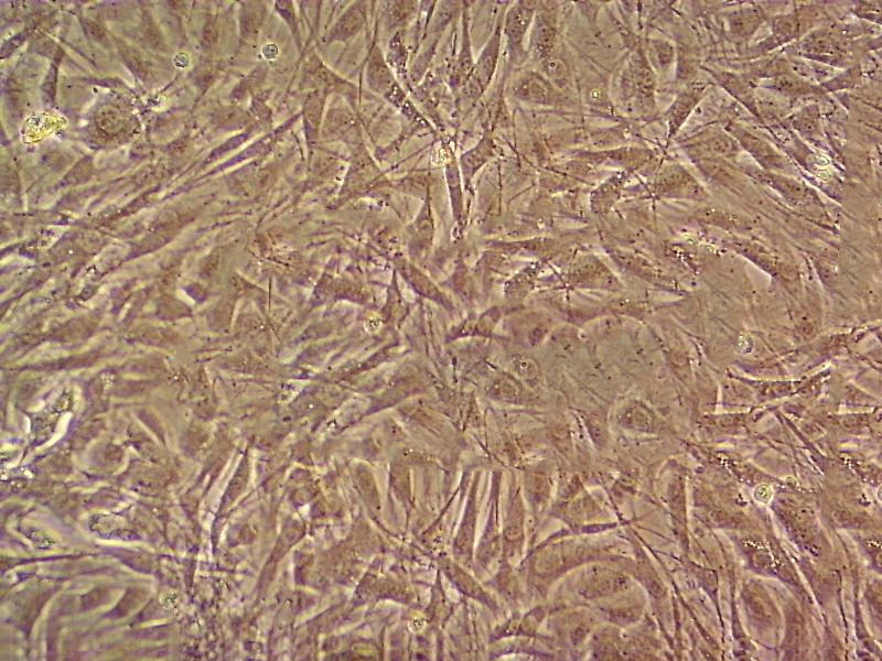 SK-MEL-1 Cell|人皮肤黑色素瘤细胞