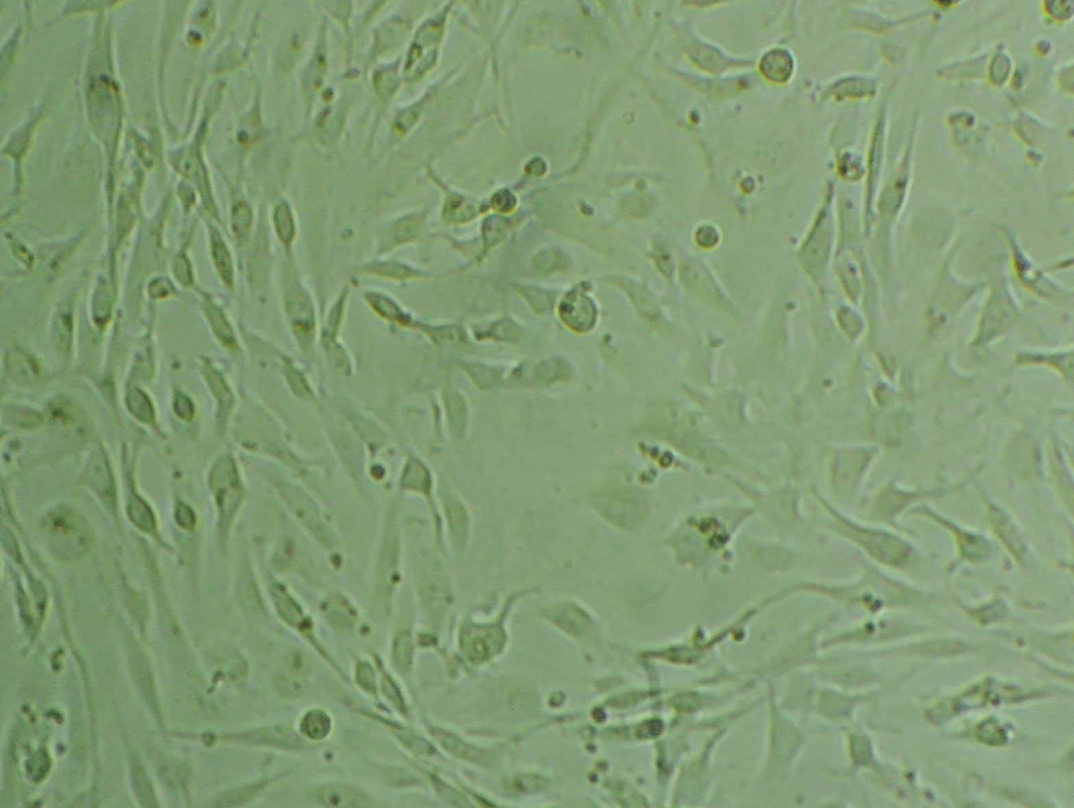 TGBC11TKB Cell|人胃癌细胞