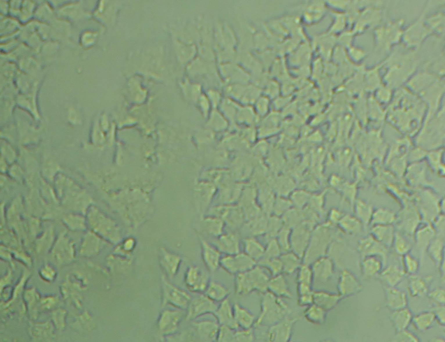 HSC-3 Cell|人口腔鳞癌细胞