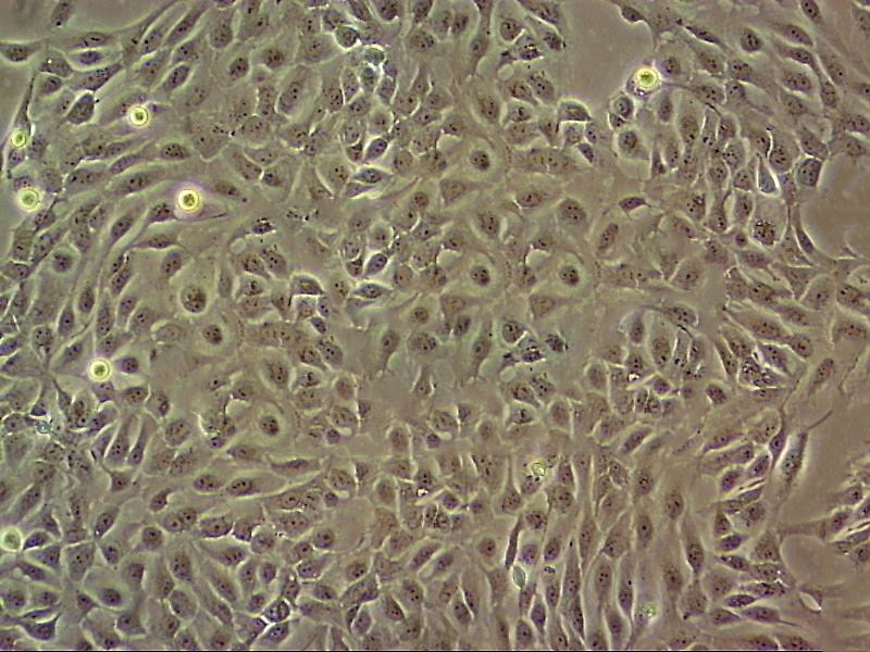 SCC-25 Cell|人口腔鳞癌细胞