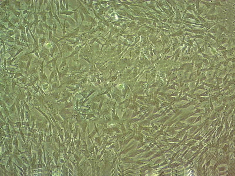 TCCSUP Cell|人膀胱移行细胞癌细胞