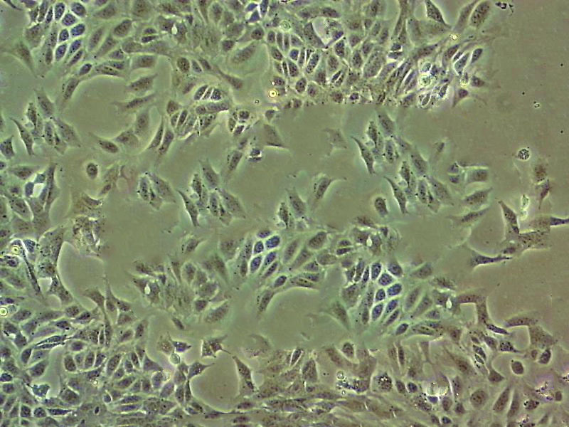 BpRc1 Cell|小鼠肝癌细胞