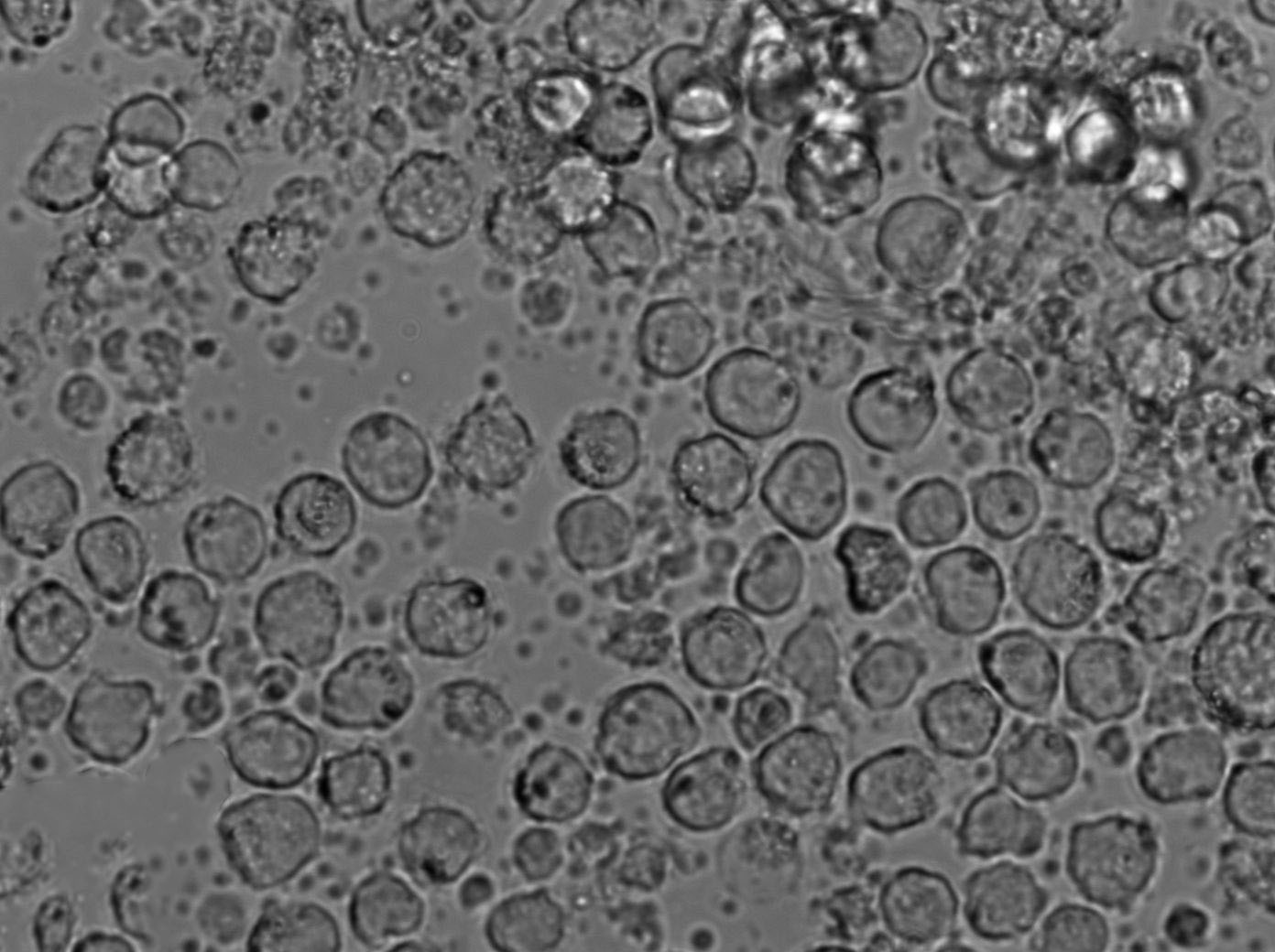 BALL-1:人B淋巴细胞急性白血病复苏细胞(提供STR鉴定图谱)