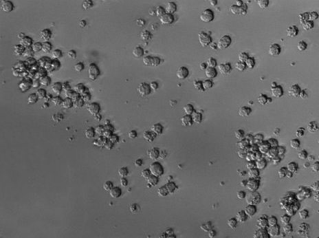 NCI-H929:人浆细胞白血病复苏细胞(提供STR鉴定图谱)