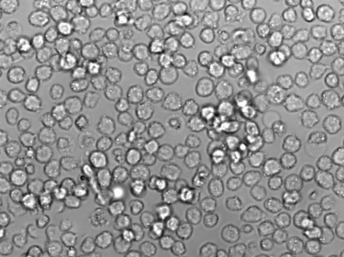 JeKo-1:人套细胞淋巴瘤复苏细胞(提供STR鉴定图谱)