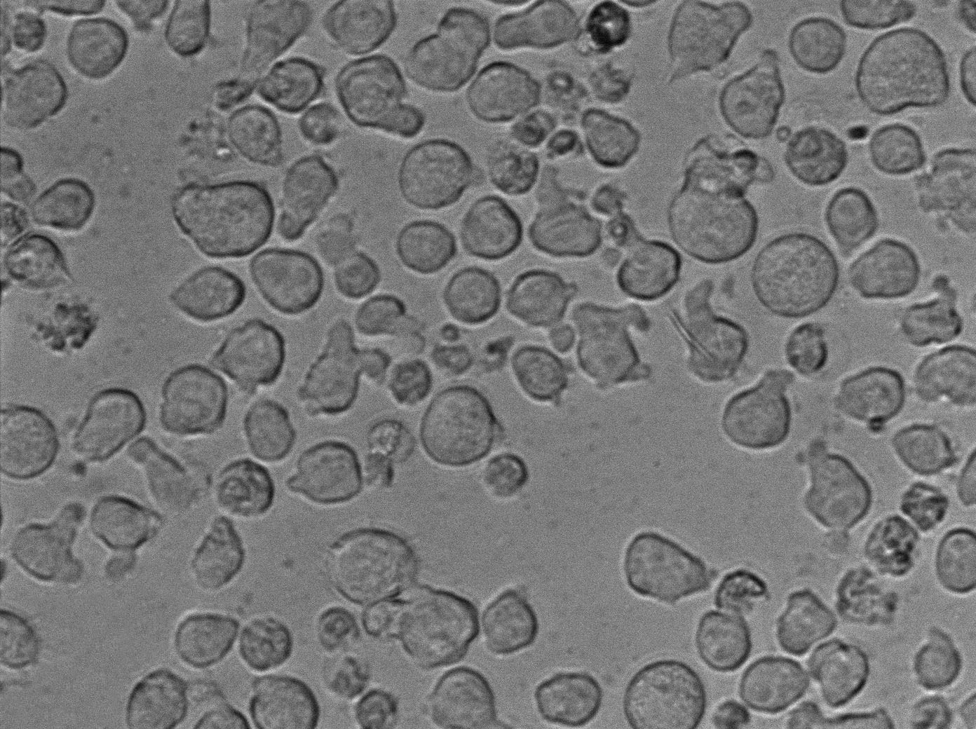 Karpas-299:人间变性大细胞淋巴瘤复苏细胞(提供STR鉴定图谱)