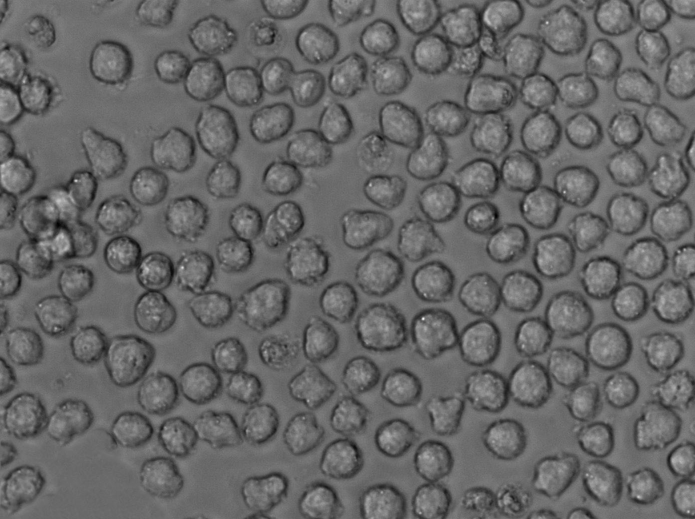 OCI-Ly10:人弥漫大B细胞淋巴瘤复苏细胞(提供STR鉴定图谱)