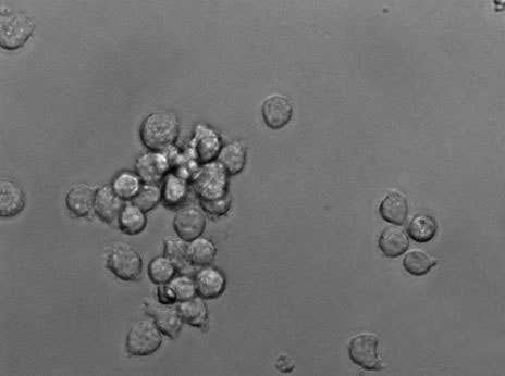 MOLM-14:人急性髓系白血病复苏细胞(提供STR鉴定图谱)