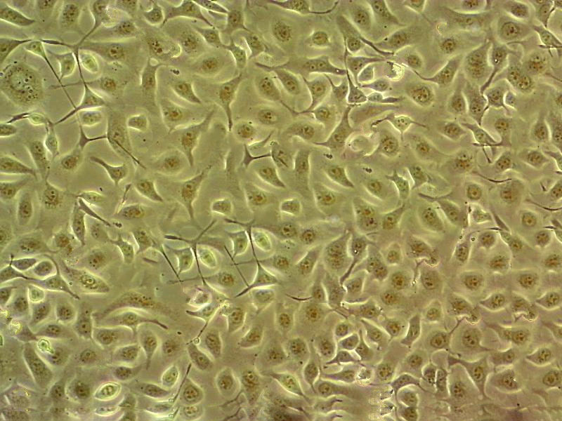 Hepa 1-6 Cell|小鼠肝癌细胞