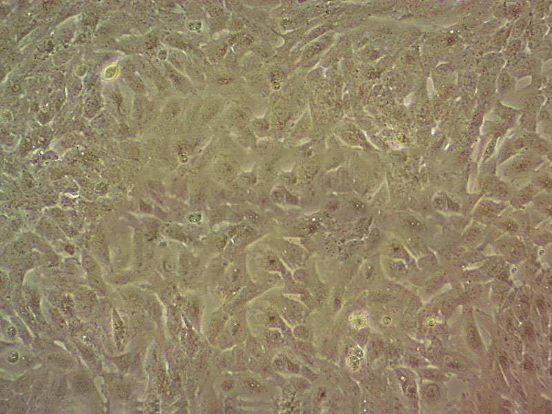 Lu-65 Cell|人大细胞肺癌细胞