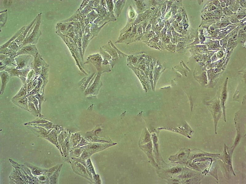 MES-SA/Dx5 Cell|人子宫肉瘤细胞