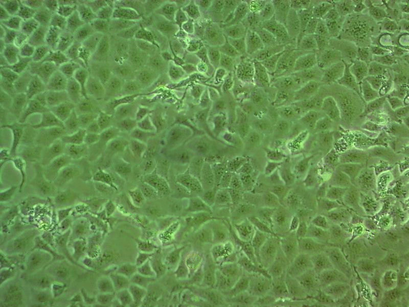 NCI-ADR-RES Cell|卵巢腺癌细胞