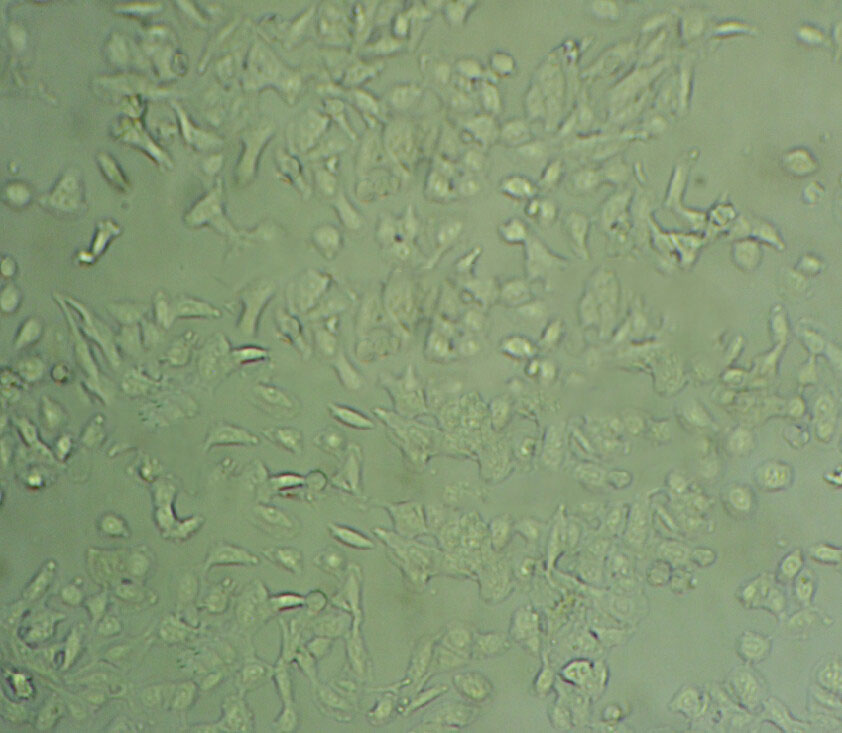 OVCAR-3 Cell|人卵巢腺癌细胞