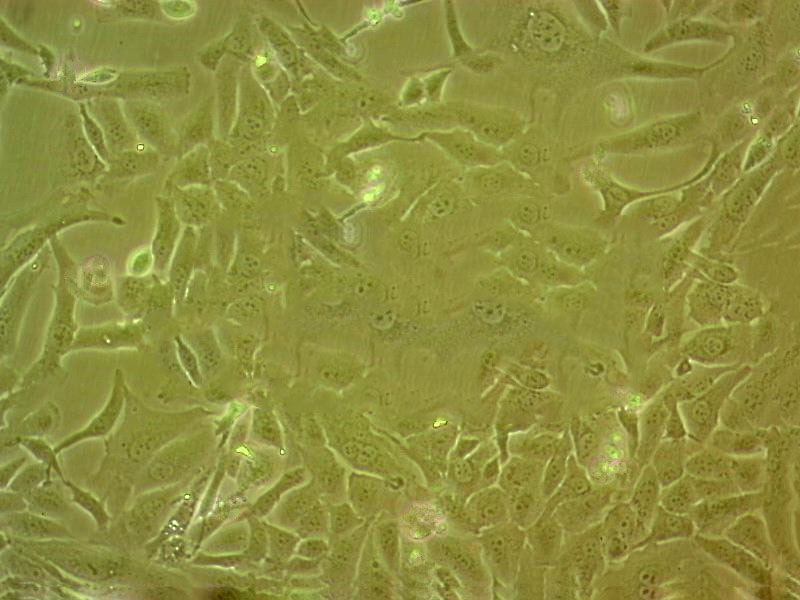 TE-14 Cell|人食管癌细胞