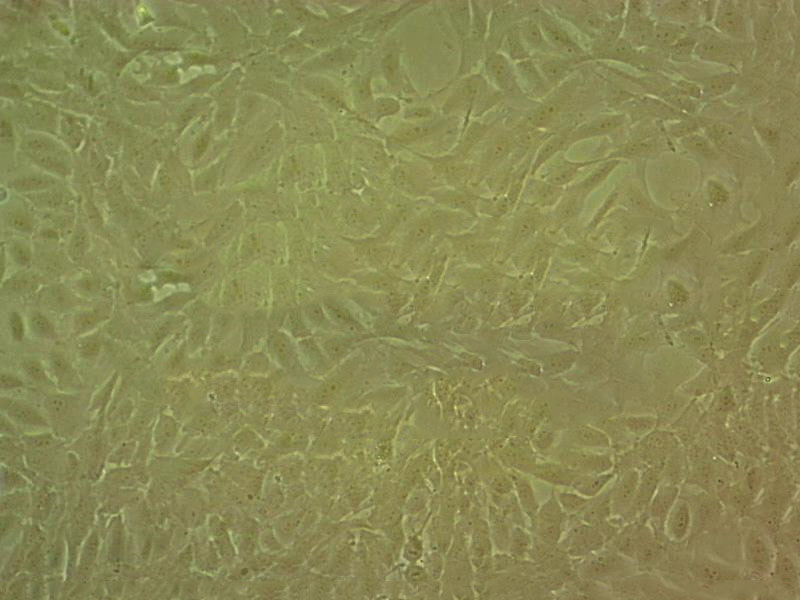 NCI-H2122 Cell|人肺癌细胞TE-8 Cell|人食管癌细胞