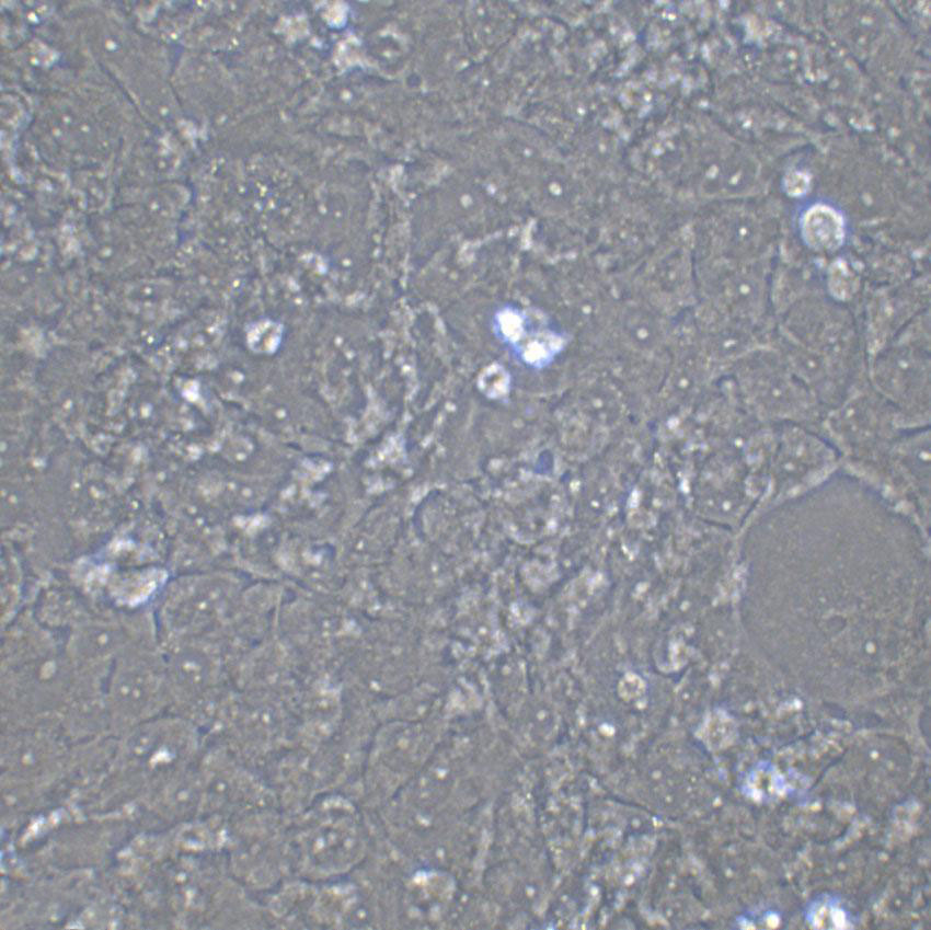 IA-LM Cell|人大细胞癌细胞