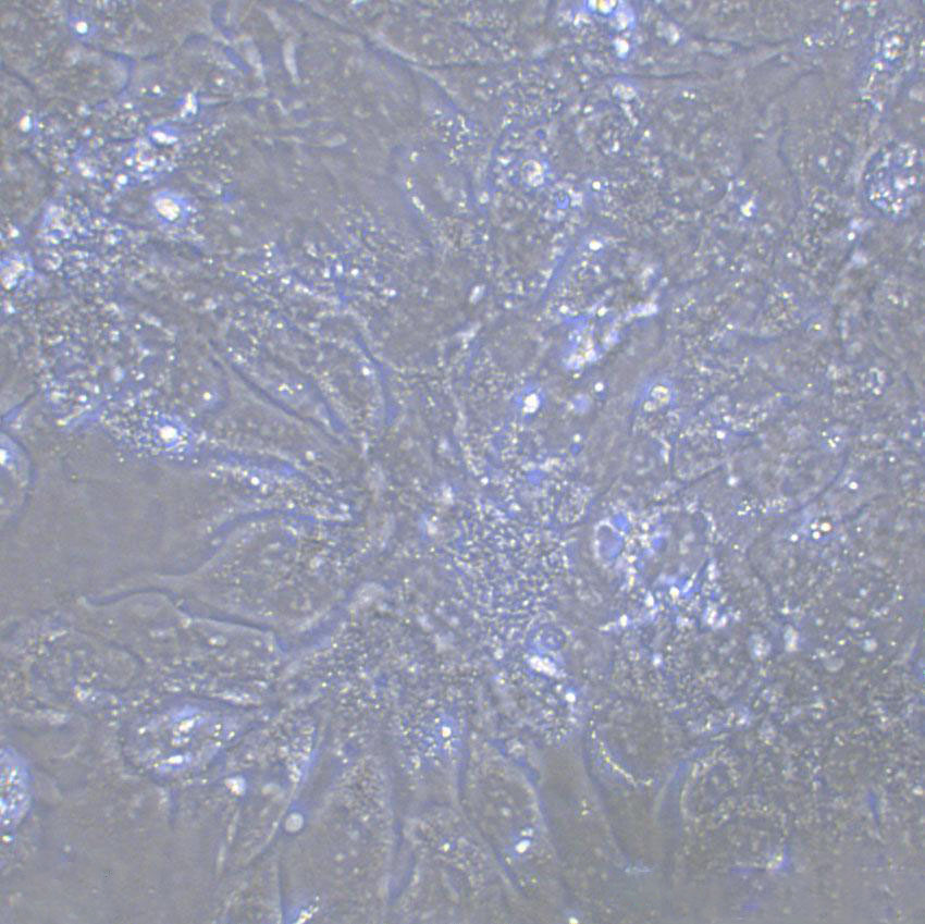ECC10 Cell|人子宫内膜癌细胞