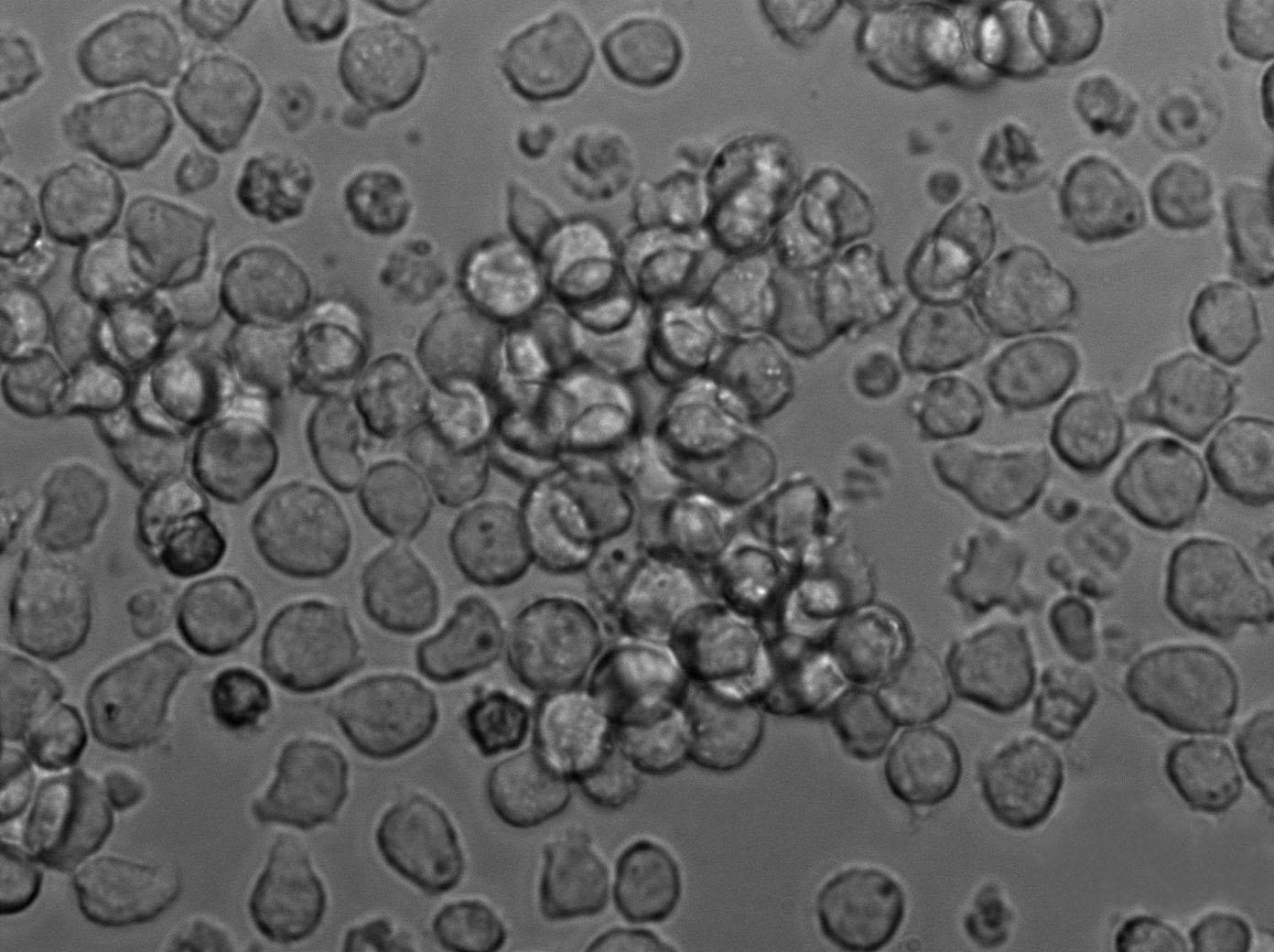 Mino Cell Lines:人淋巴细胞瘤细胞(STR认证)