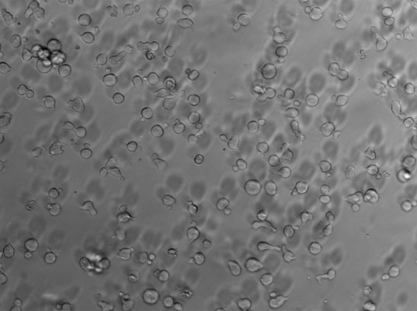 Namalwa Cell Lines:人Burkitt＇s淋巴瘤细胞(STR认证)