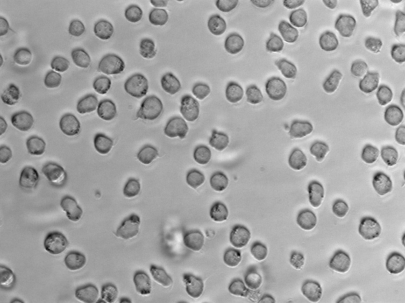 CCRF-CEM Cell Lines:人急性淋巴细胞白血病T淋巴细胞(STR认证)