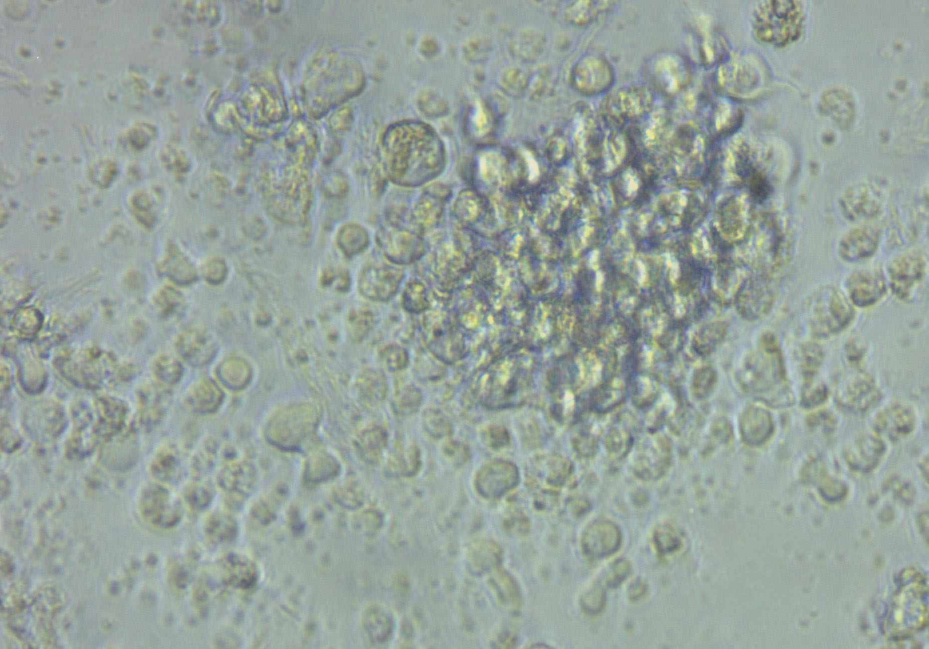 Jurkat Cell Lines:人急性T淋巴细胞白血病细胞(STR认证)