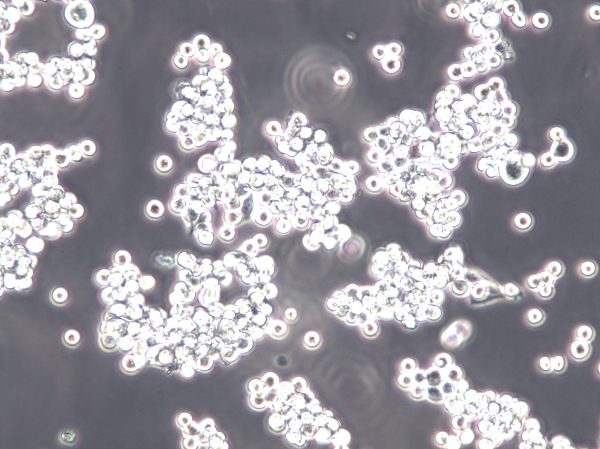 EHEB Cell Lines:人慢性B细胞白血病细胞(STR认证)