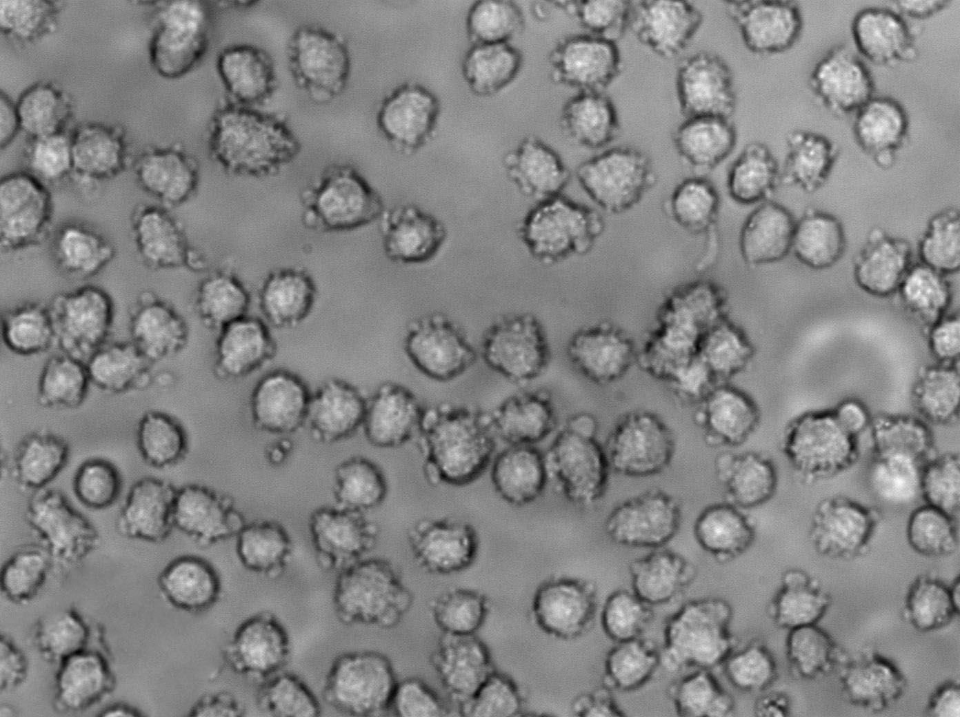 OCI-Ly3 Cell Lines:人弥漫大B细胞淋巴瘤细胞(STR认证)