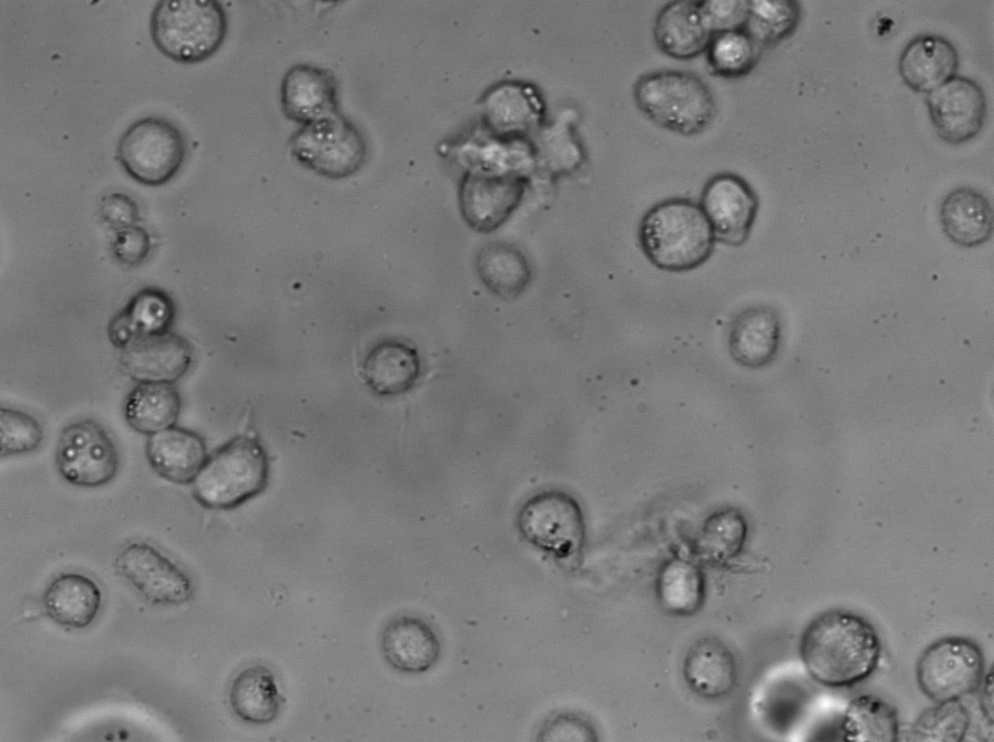 NK-92 Cell Lines:人恶性非霍奇金淋巴瘤患者NK细胞(STR认证)