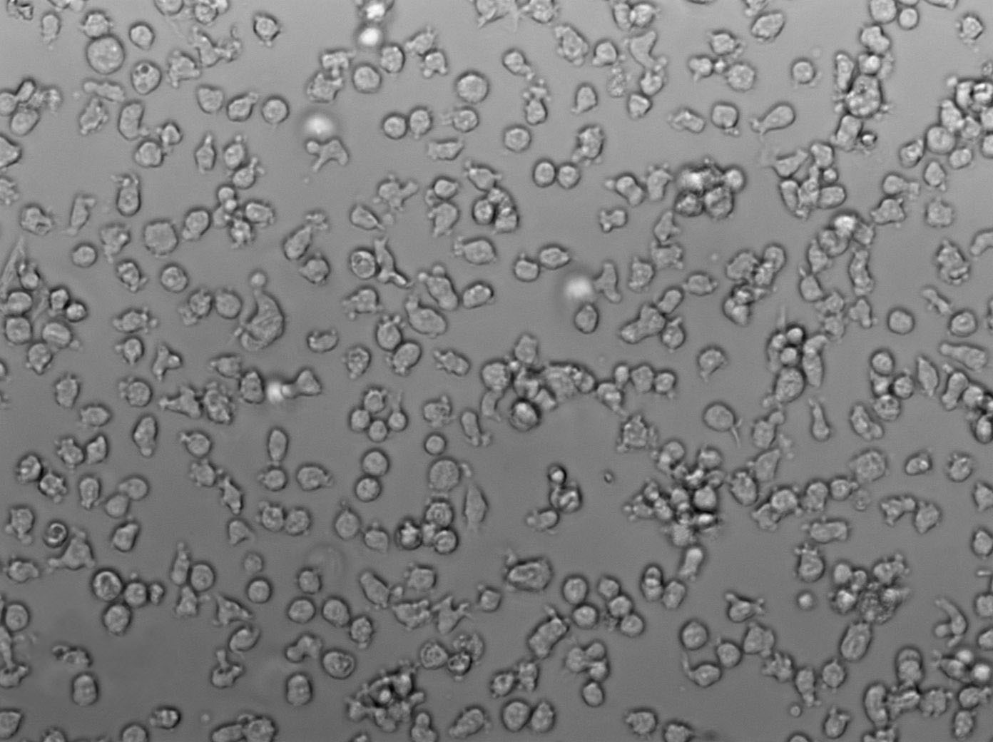 SU-DHL-2 Cell Lines:人弥漫性大细胞淋巴瘤细胞(STR认证)