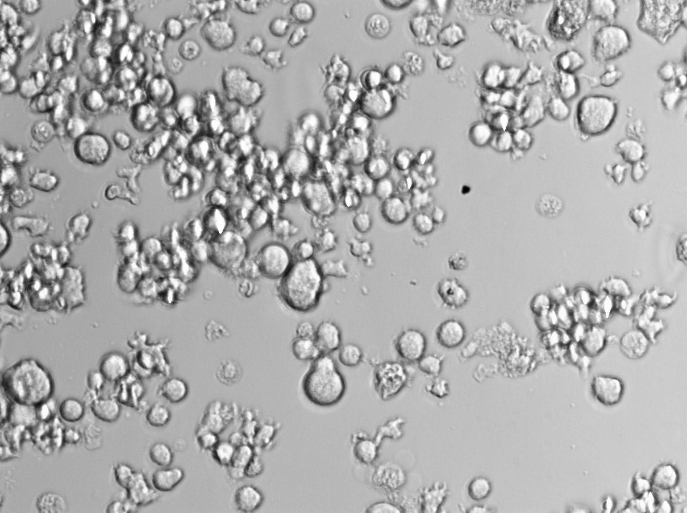 OCI-Ly1 Cell Lines:人弥漫大B淋巴瘤细胞(STR认证)