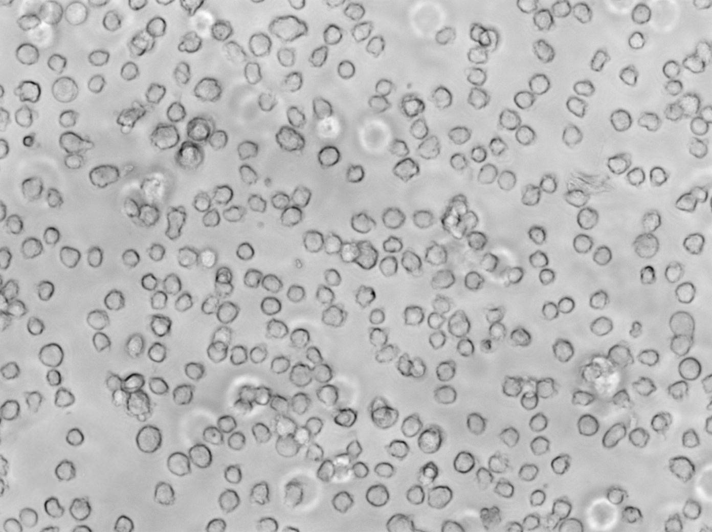 C8166 Cell Lines:人T淋巴细胞白血病细胞(STR认证)