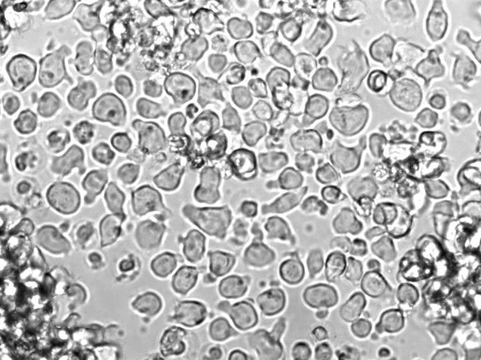 HDLM-2 Cell Lines:人霍奇金淋巴瘤细胞(STR认证)