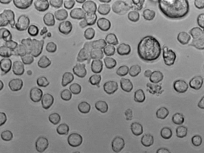 KM-H2 Cell Lines:人霍奇金淋巴瘤细胞(STR认证)