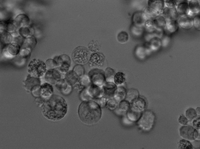 TK-1 Cell Lines:小鼠T淋巴瘤细胞(STR认证)