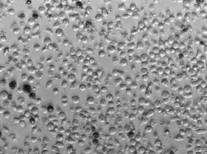 OCI-Ly8 Cell Lines:人弥漫大B淋巴瘤细胞(STR认证)