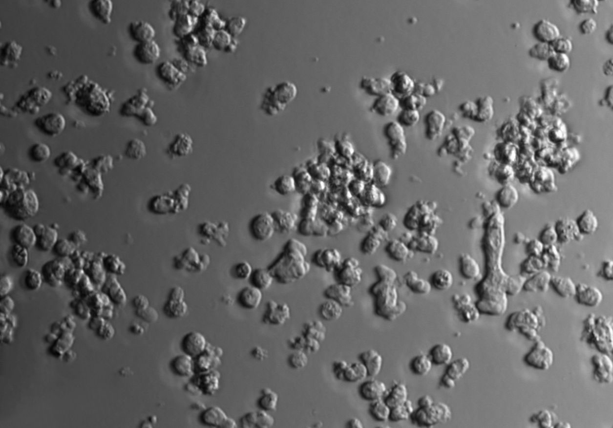 Hs 445 Cell Lines:人霍奇金淋巴瘤细胞(STR认证)