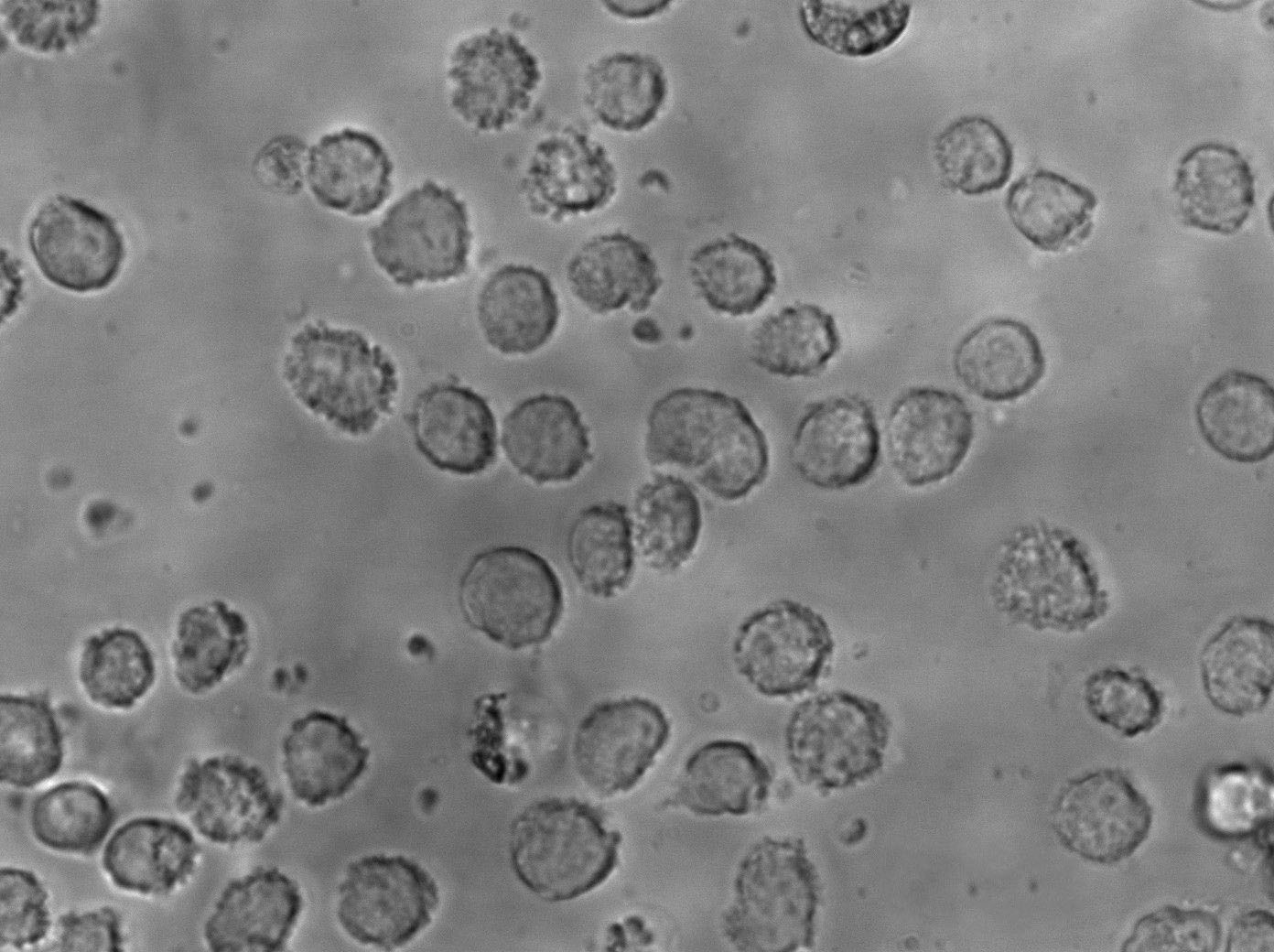 WEHI-279 Cell Lines:小鼠淋巴瘤细胞(STR认证)