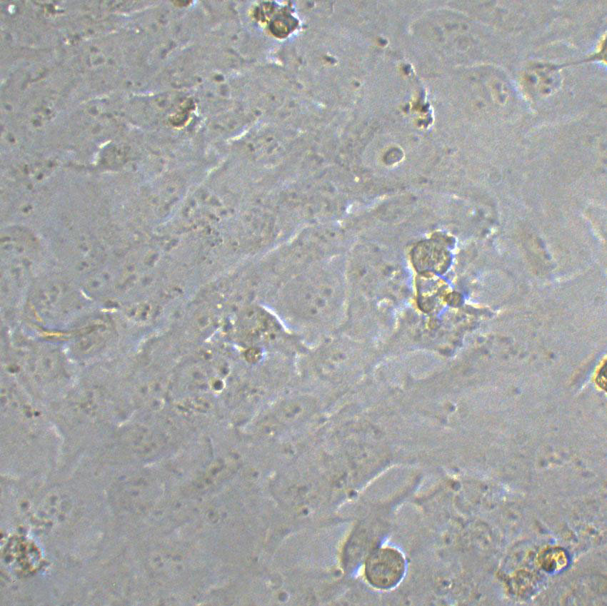 BIU-87 Cell|人膀胱癌细胞