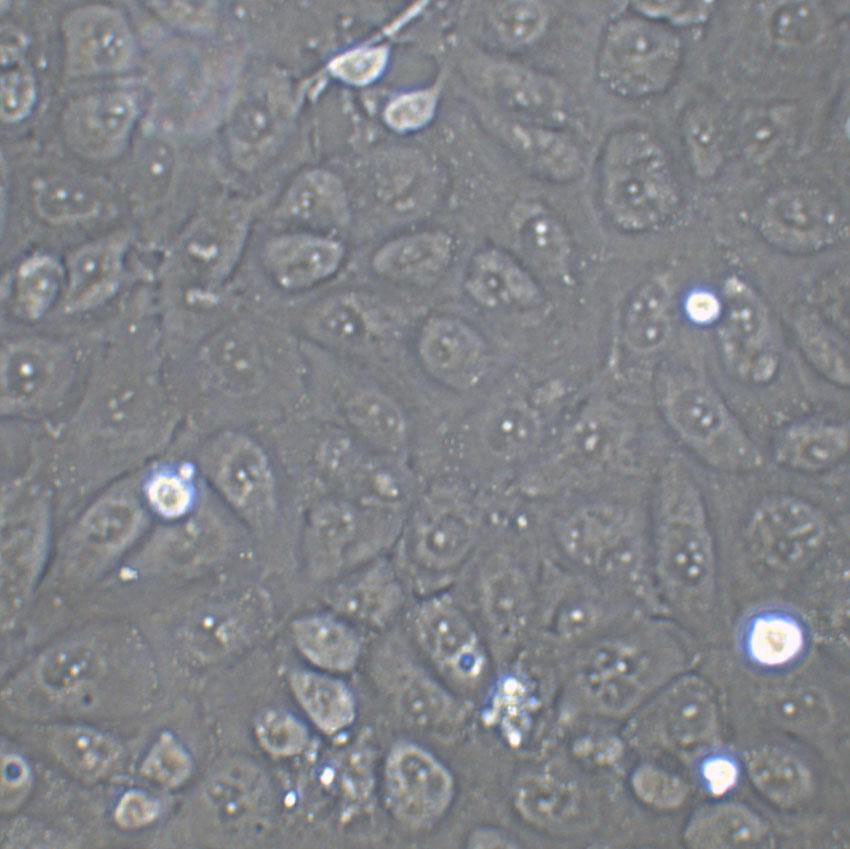 16HBE14o- Cell|人支气管上皮样细胞