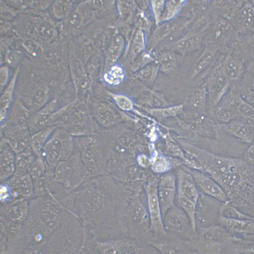 QBC939 Cell|人胆管癌细胞