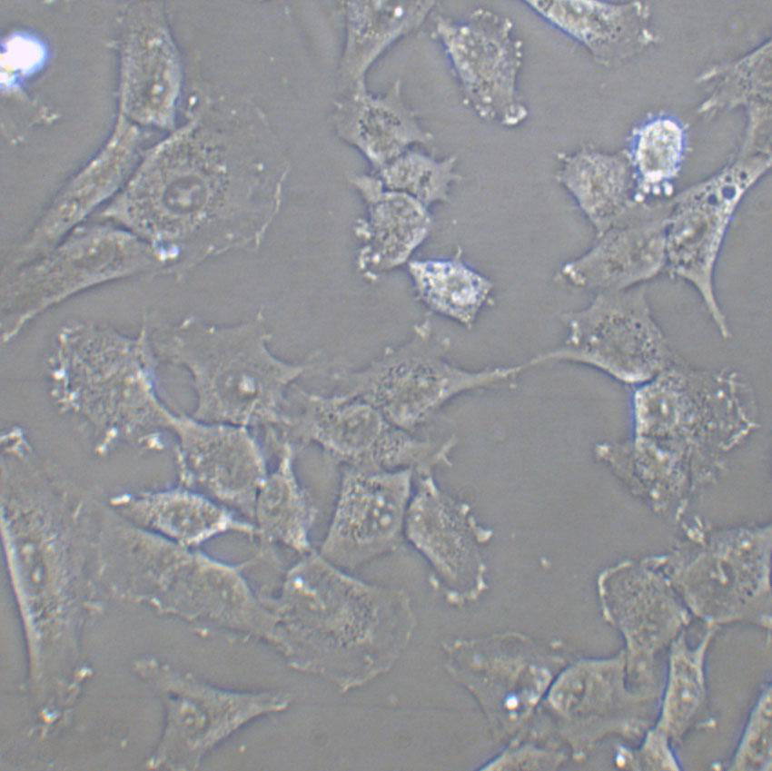 SNU-216 Cell|人胃癌细胞