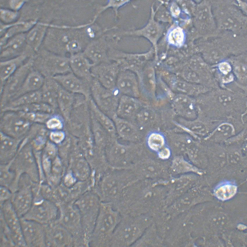 C918 Cell|人眼脉络黑色瘤细胞