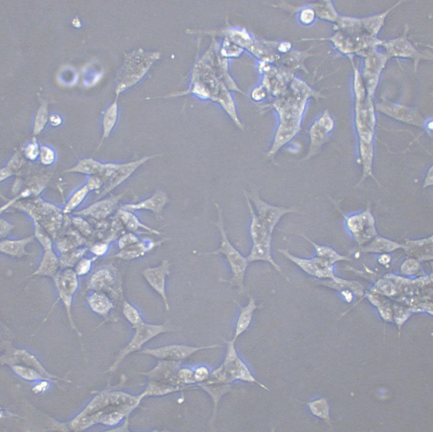 5-8F Cell|鼻咽癌细胞