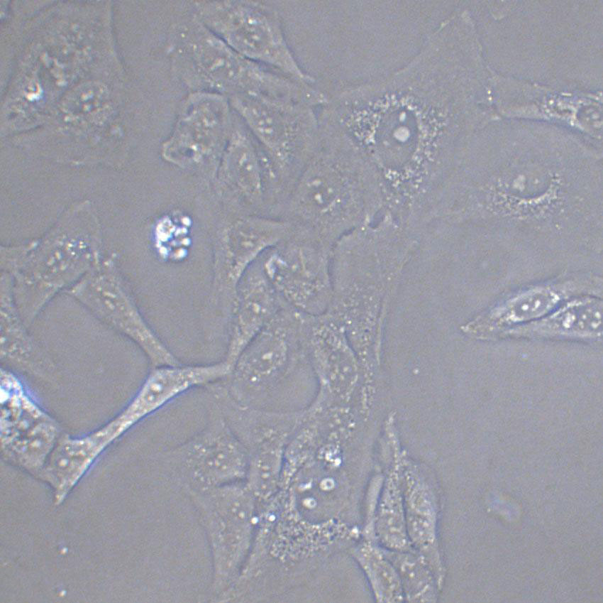 Li-7 Cell|人肝癌细胞